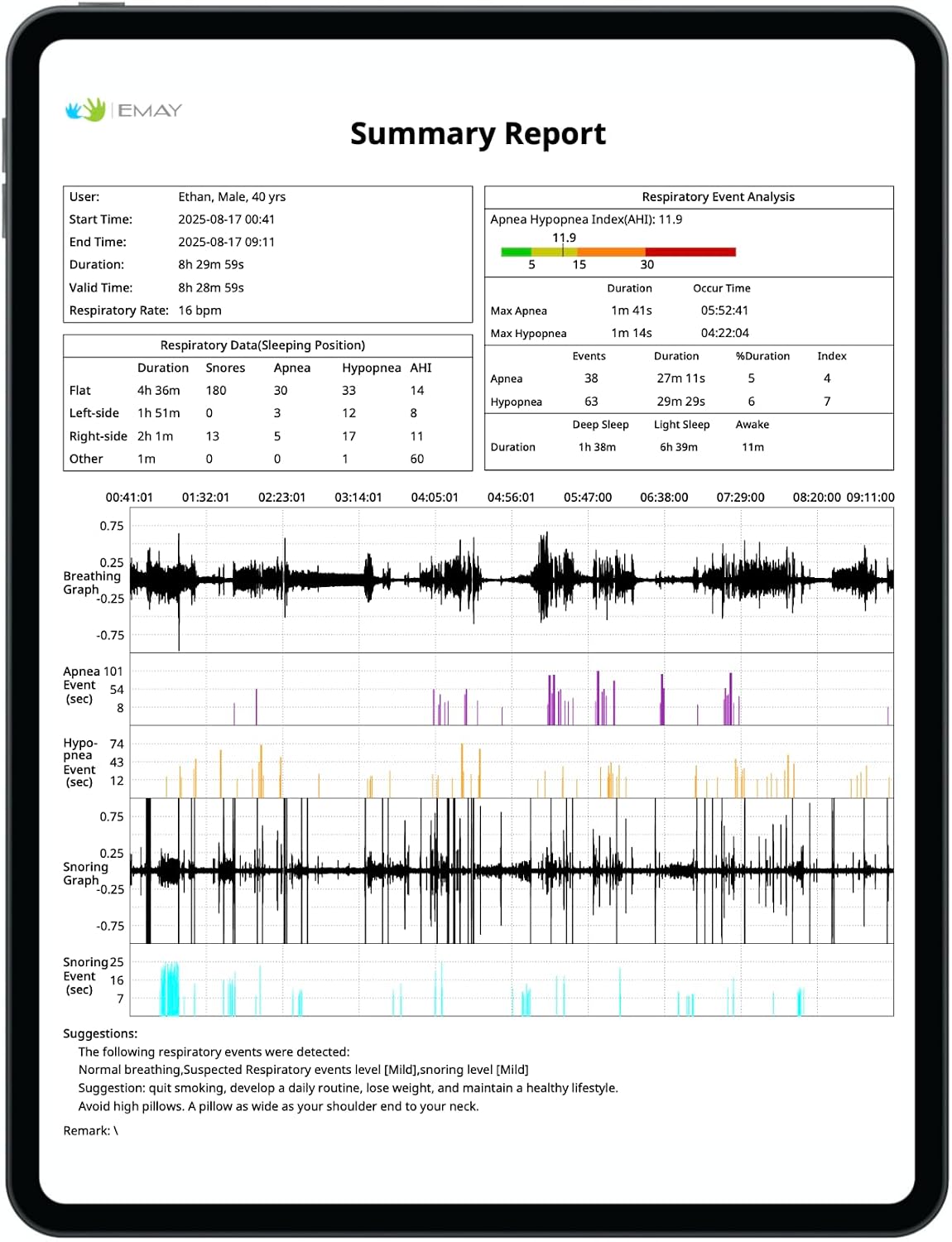 EMAY Sleep Breathing Monitor for Airflow Tracking | Record Breathing Continuously On the App | Monitor Sleep Quality and Respiratory Events | Generate Professional Sleep Report with Data Analysis