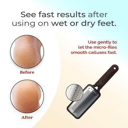 Microplane Colossal Foot File Scraper - The Original Stainless Steel Foot Rasp, Dead Skin/Callus Remover for Feet, Gentle Foot Scrubber, Pedicure Tools for Salon-Quality Foot Care, Black