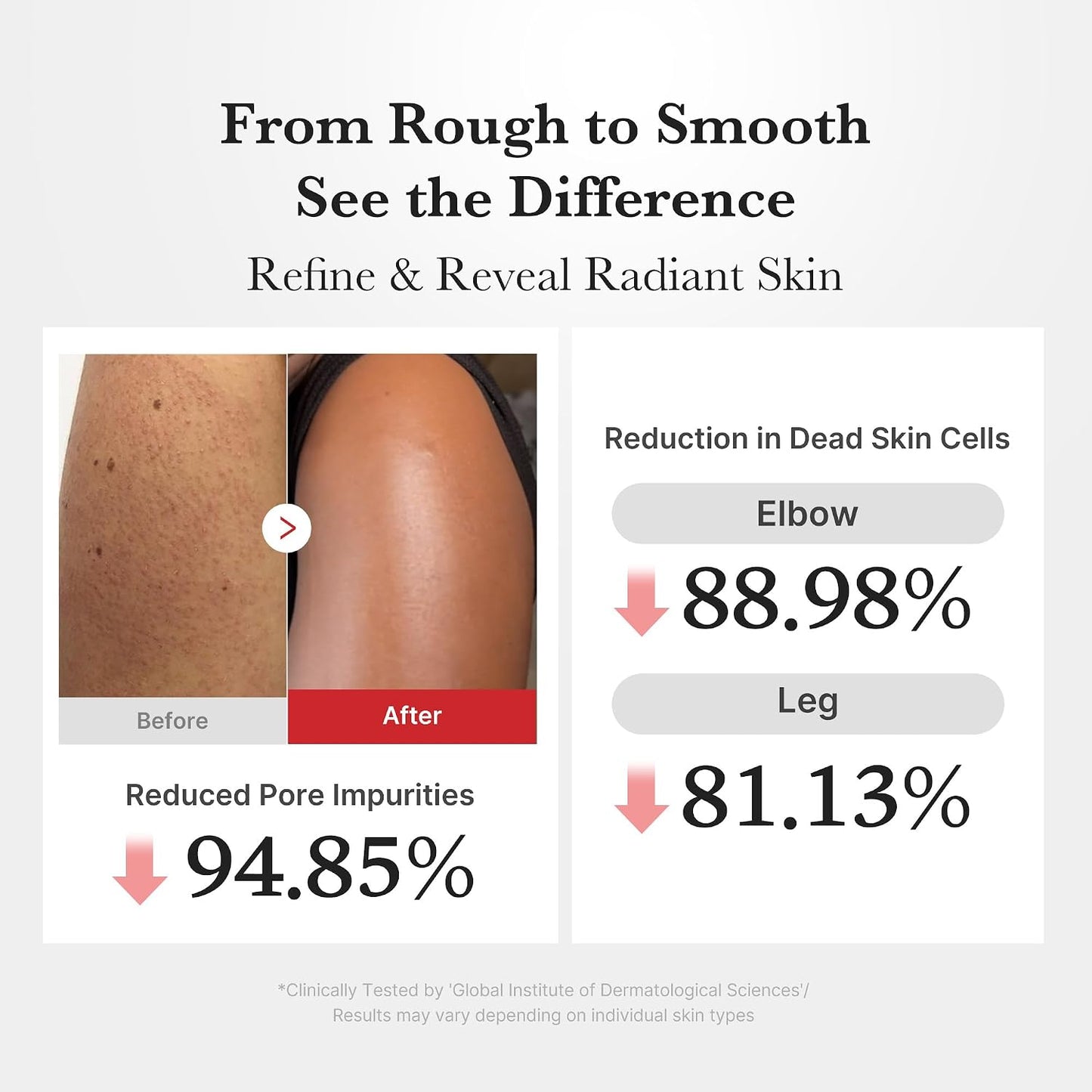medicube Body Peel Shot with Kojic Acid and Turmeric | Gentle Body Brightening & Exfoliating Serum with BHA, LHA & PHA for Dead Skin Cells, Uneven Looking Skin & Excess Sebum | 9.46 fl.oz