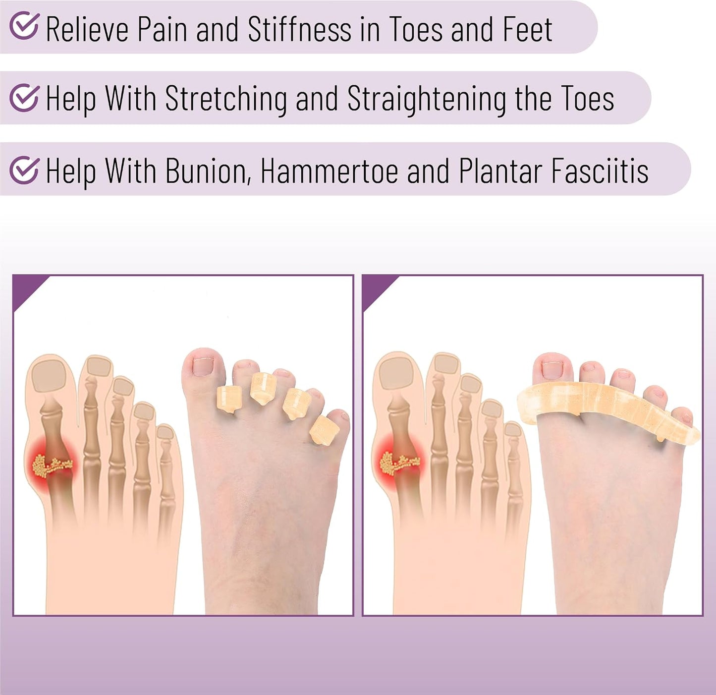 DR. JK- ToePal Gel Toe Separator, 2 Pairs, Toe Spacers, Toe Straightener, Hammer Toe Straightener, Toe Spreader, Toe Stretcher, Toe Corrector for Women and Men, Bunion Corrector