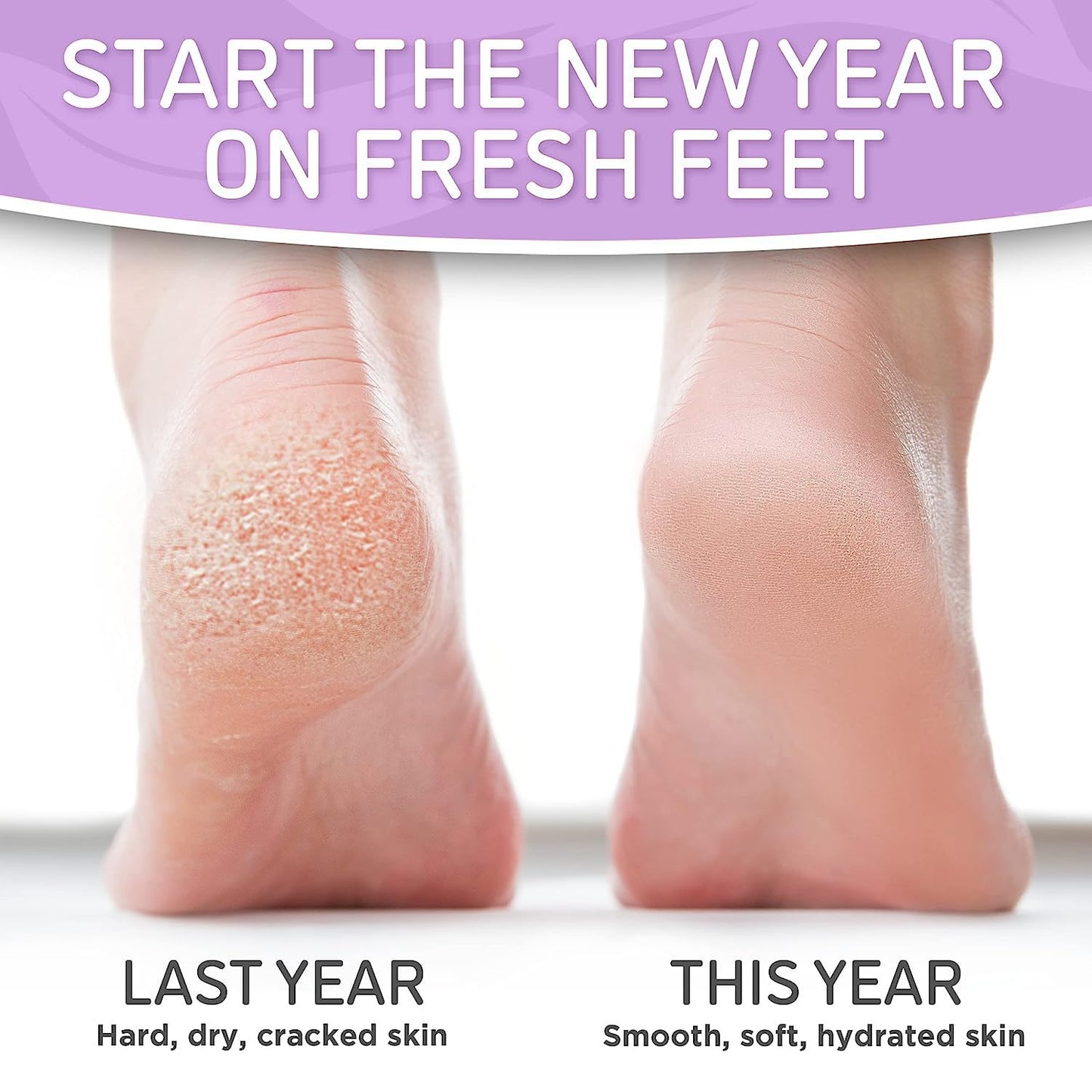 Dermora Soft Touch Foot Peel Mask - Pack of 2 Feet Peeling Masks for Dry, Cracked Heels & Calluses - Exfoliating Foot Mask Peel for Baby Soft Skin (Original)