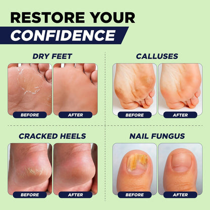 FOOT CURE Tea Tree Oil Foot Soak with Epsom Salt - Best Toenail Fungus Treatment, Athletes Foot & Softens Calluses - Soothes Sore & Tired Feet, Fungal Toe, Foot Odor Scent, Spa Pedicure (Pack of 2)