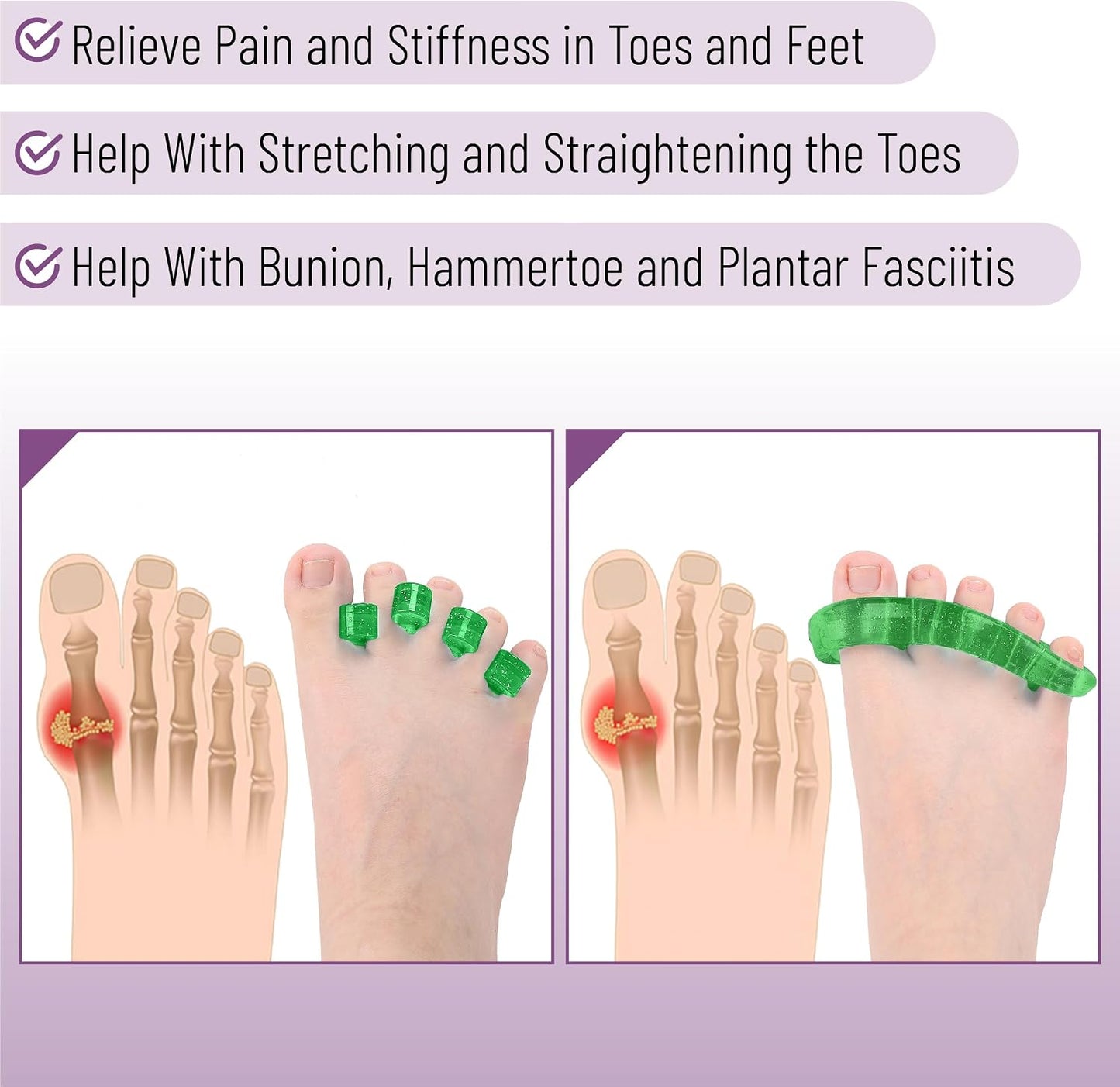 DR. JK- ToePal Gel Toe Separator, 2 Pairs, Toe Spacers, Toe Straightener, Hammer Toe Straightener, Toe Spreader, Toe Stretcher, Toe Corrector for Women and Men, Bunion Corrector