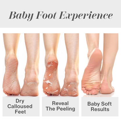 Baby Foot Original Exfoliation Foot Peel - For Rough Cracked, Dry Feet, Dead Skin Removal - Foot Peeling Mask for Baby Soft Feet - Spa Experience at Home & Gift Ideas - Lavender Scented