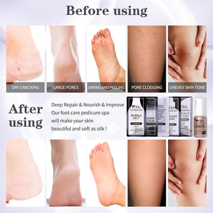 Pedicure Kit Foot Soak Set: Bubble Salt, Sugar Scrub, Massage Mask, Massage Lotion in a Box, 4 Step Foot Spa Kit for Dry Feet, Softens Calluses, Tired Feet（3 Set Lavender) - Colors B