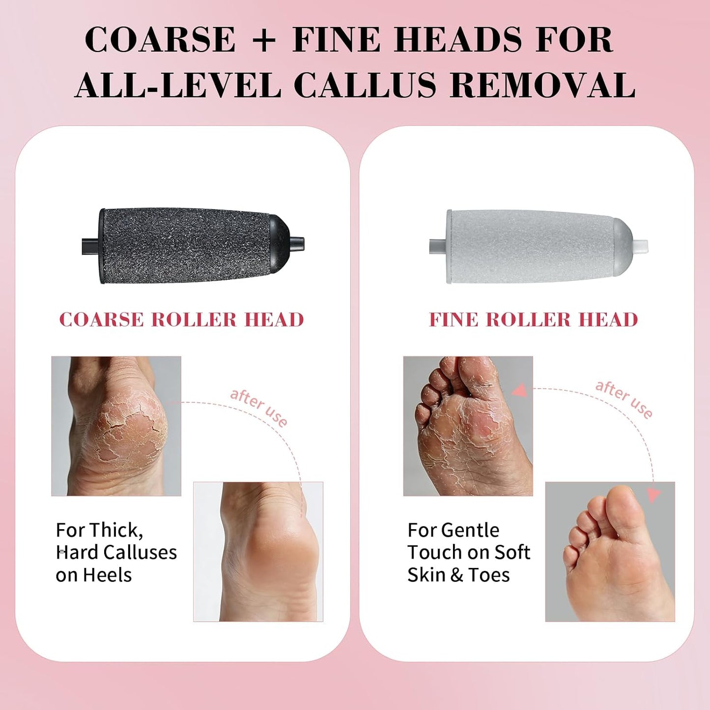 Foot Callus Remover, Electric Callus Remover for Feet with Dual Roller Heads, 2 Speeds & LED Light, 3× Faster Than Manual, 90-Min Runtime, Pedicure Tools for Feet, Foot File for Home Use