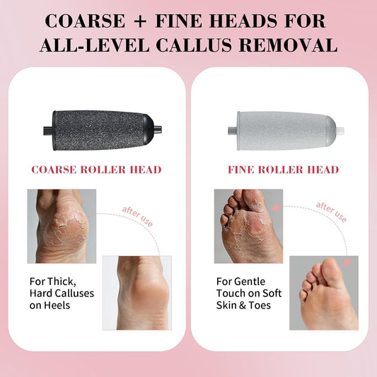 Foot Callus Remover, Electric Callus Remover for Feet with Dual Roller Heads, 2 Speeds & LED Light, 3× Faster Than Manual, 90-Min Runtime, Pedicure Tools for Feet, Foot File for Home Use