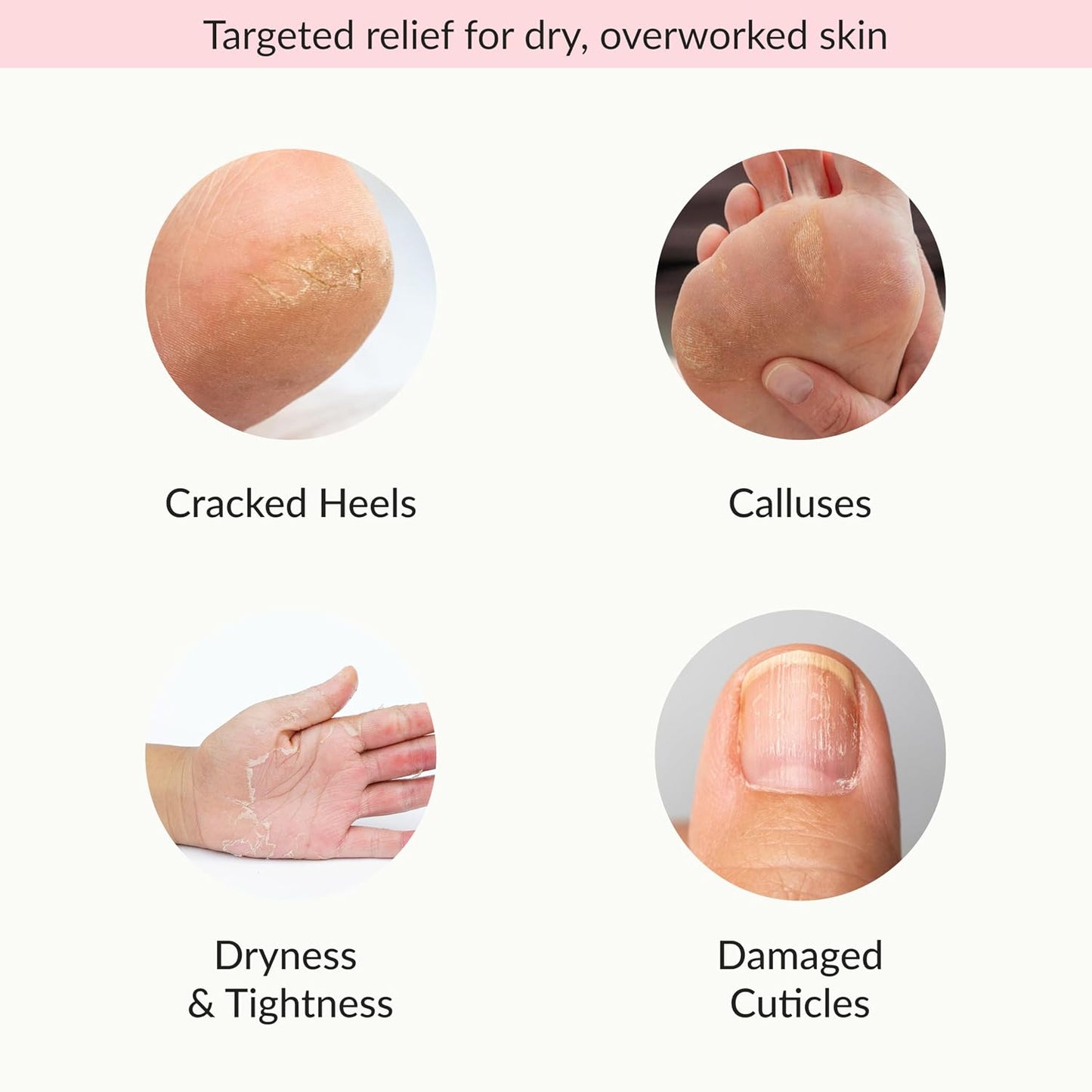 Epielle Hydrating Foot Mask 6 Pairs, Relieve and Soften with Shea Butter & Jojoba Oil, Deep Moisturizing Socks for Dry, Cracked Feet, Self Care Gifts for Women, Spa Kit