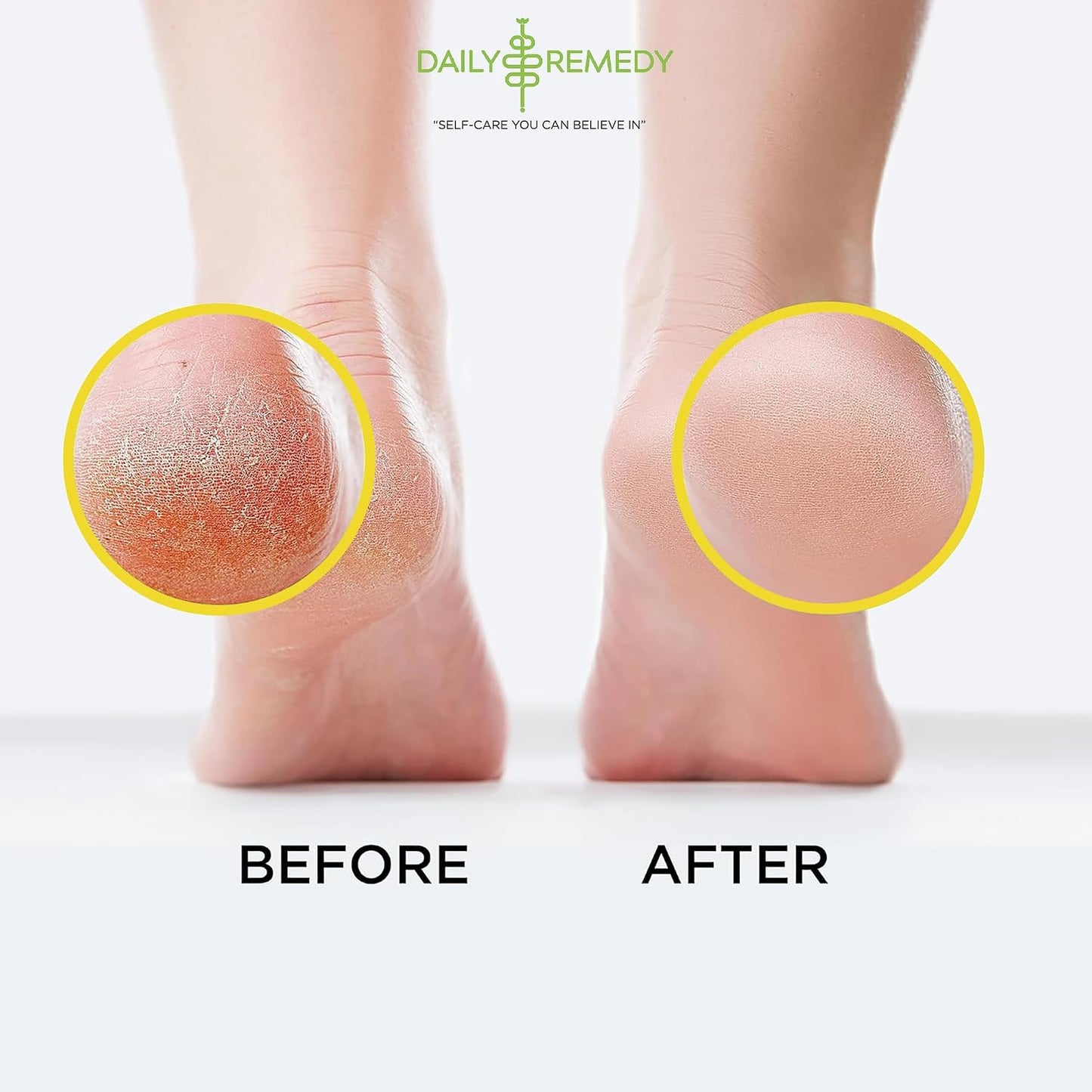 Muscle Relief Foot Soak with Epsom Salt, Made in USA, Soothe Tired Feet, Softens Calluses and Helps Athletes Foot 1lbs