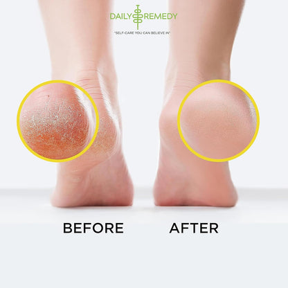 Muscle Relief Foot Soak with Epsom Salt, Made in USA, Soothe Tired Feet, Softens Calluses and Helps Athletes Foot 1lbs