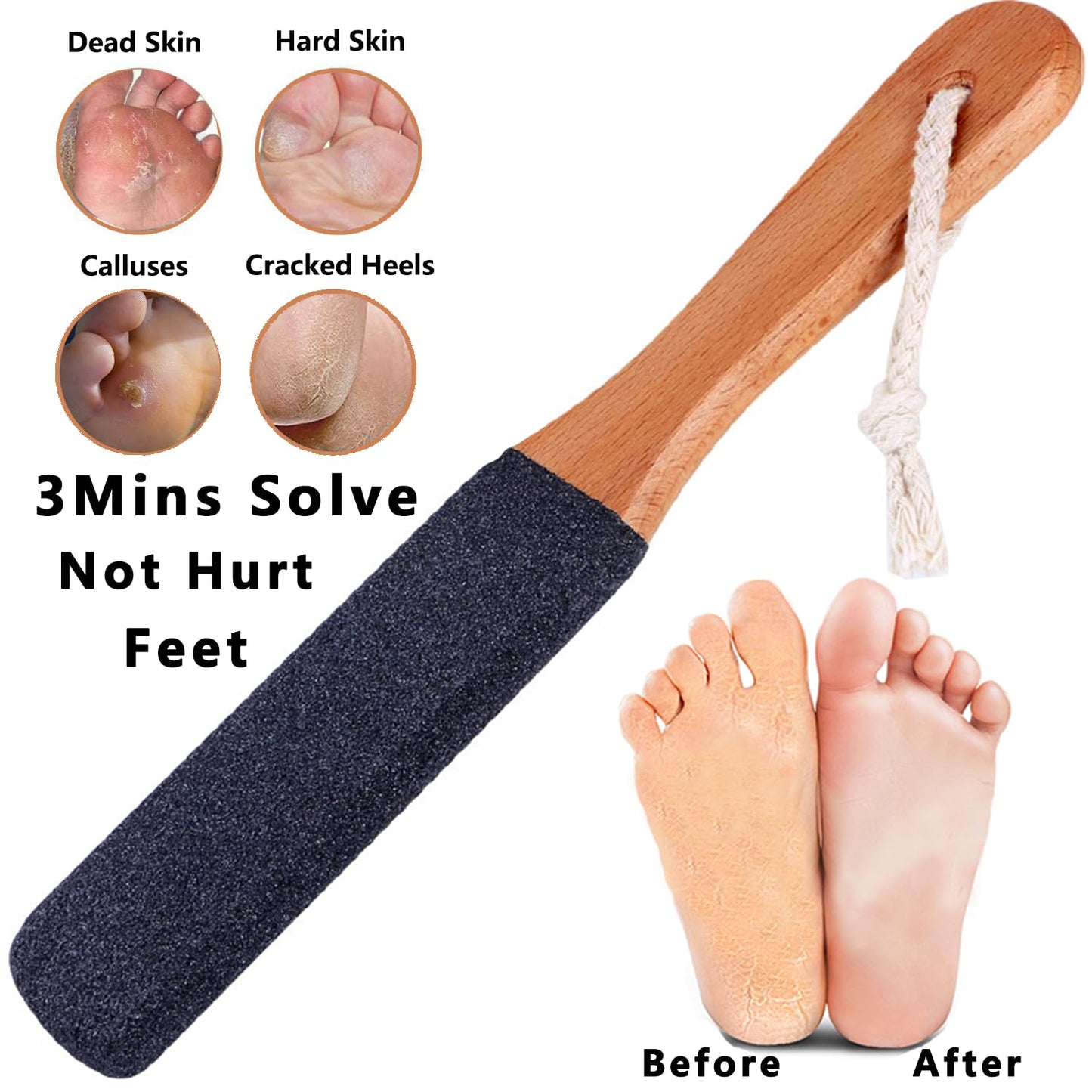Kinepi Foot File & Foot Scrubber,Pumice Stone for Feet Callus Remover | Pedicure foot rasp helps smooth cracked heels,dead skin,and hard skin after shower for wet or dry daily and weekly foot care