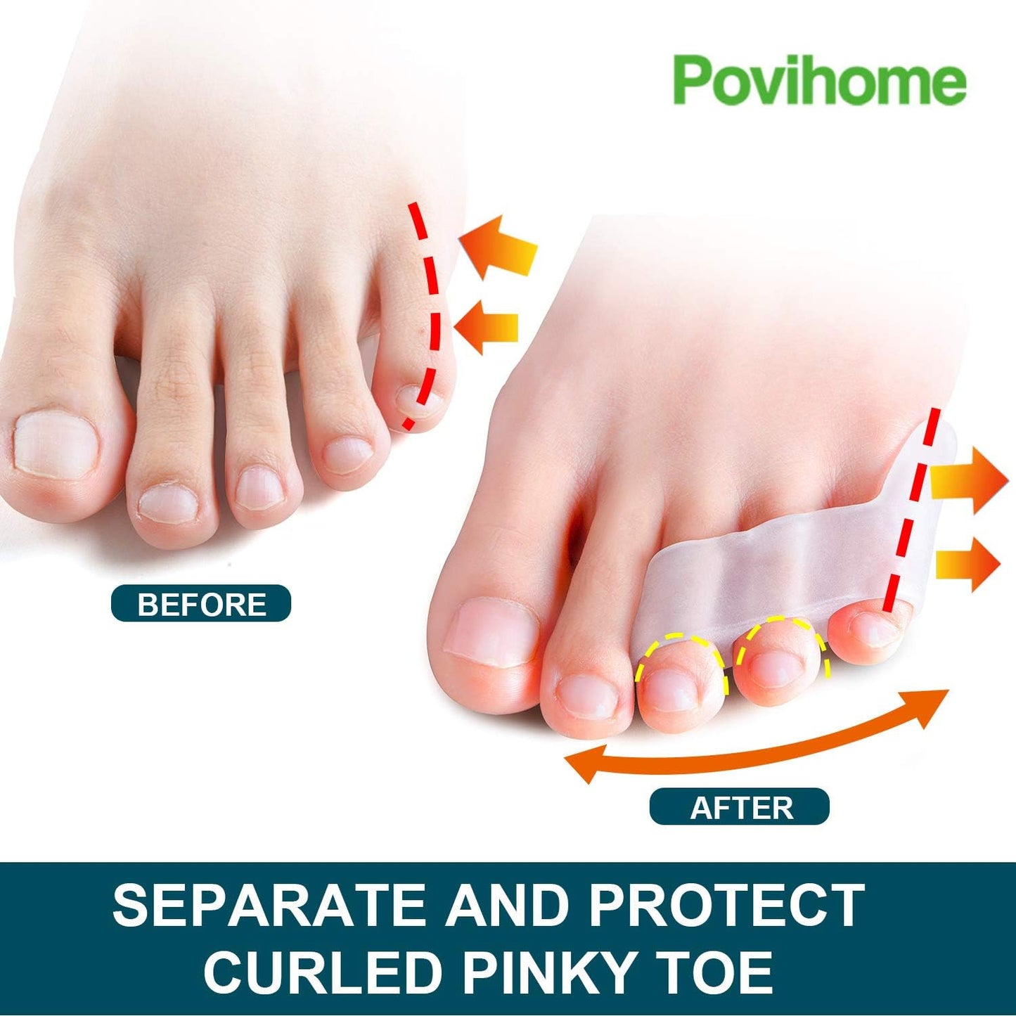 Povihome 10 Pack Pinky Toe Separator and Protectors for Overlapping Toe, Curled Pinky Toes - Spacers for Morton's Neuroma Pain Relief
