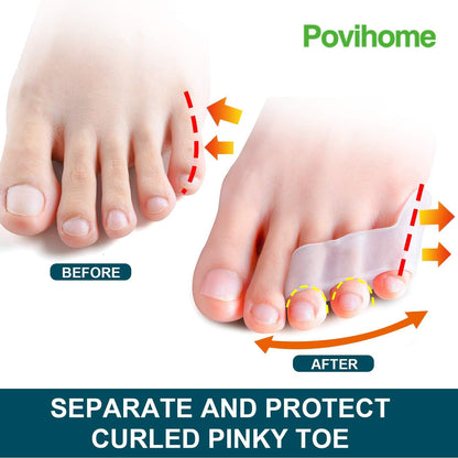 Povihome 10 Pack Pinky Toe Separator and Protectors for Overlapping Toe, Curled Pinky Toes - Spacers for Morton's Neuroma Pain Relief