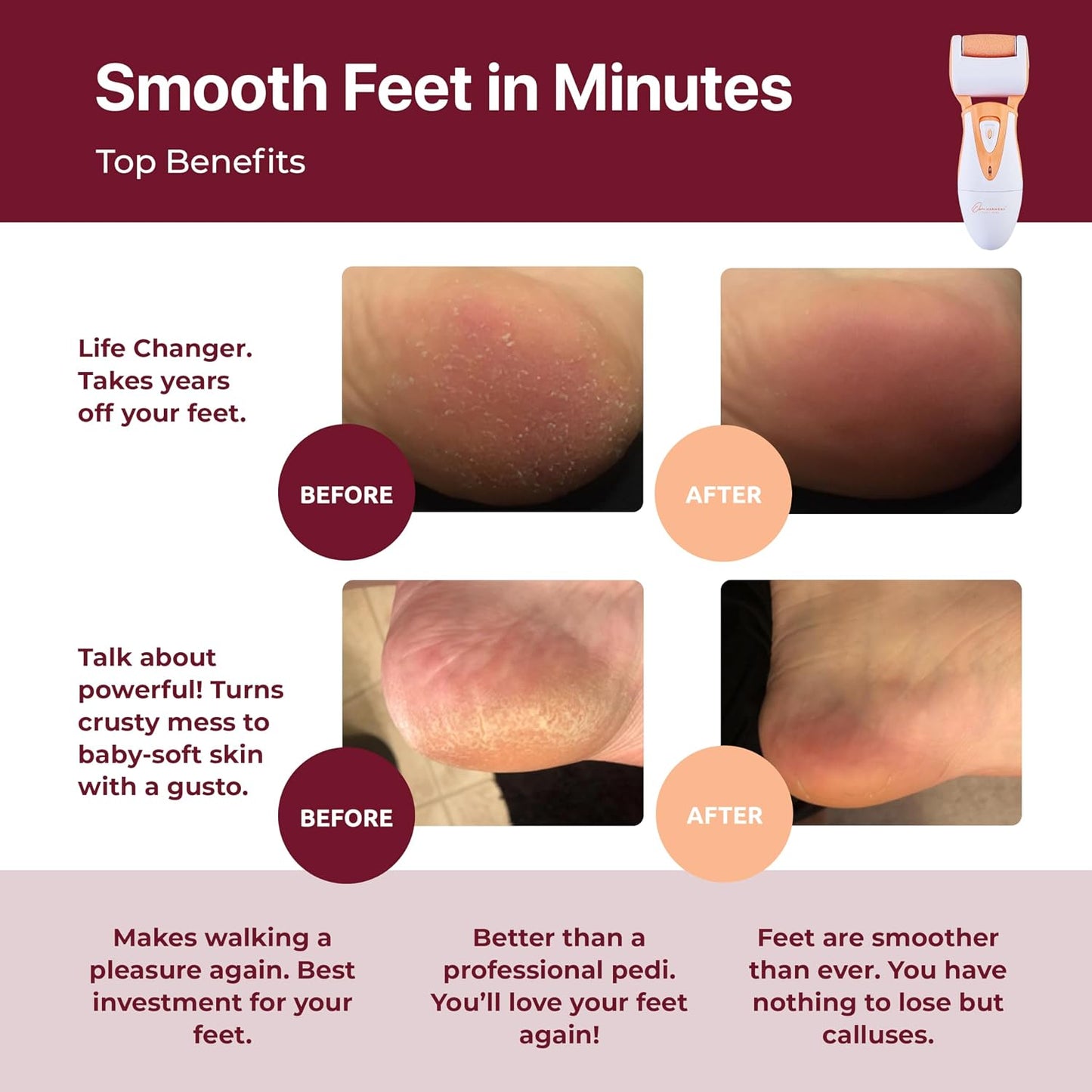 Electric Callus Remover: Rechargeable Electronic Foot File CR900 by Own Harmony (Powerful Motor) Best Pedicure Tools w 3 Rollers Professional Pedi Feet Care Sander for Cracked Heels and Hard Skin