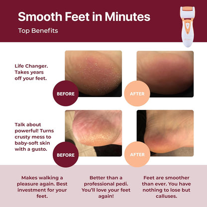 Electric Callus Remover: Rechargeable Electronic Foot File CR900 by Own Harmony (Powerful Motor) Best Pedicure Tools w 3 Rollers Professional Pedi Feet Care Sander for Cracked Heels and Hard Skin