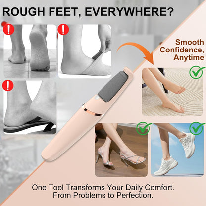 Electric Foot File, Callus Remover for Feet - Rechargeable Pedicure Tool, 2 Speeds 1700/2000 RPM & 2 Heads for Dry & Dead Cracked Skin, Cordless Waterproof Hard Skin Removal, Home Pedicure Gift