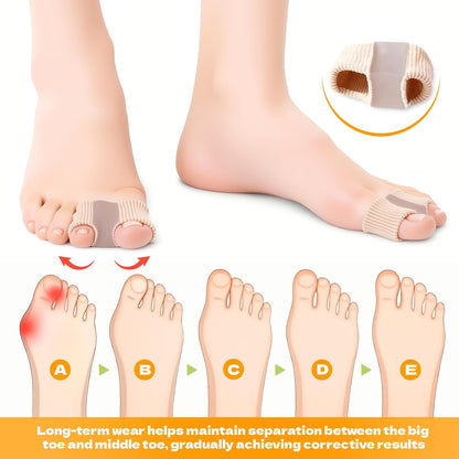 Toe Spacers, 4 PCS Toe Separators for Women and Men for Overlapping Toes, Bunion Corrector, Hammer Toe Straightene