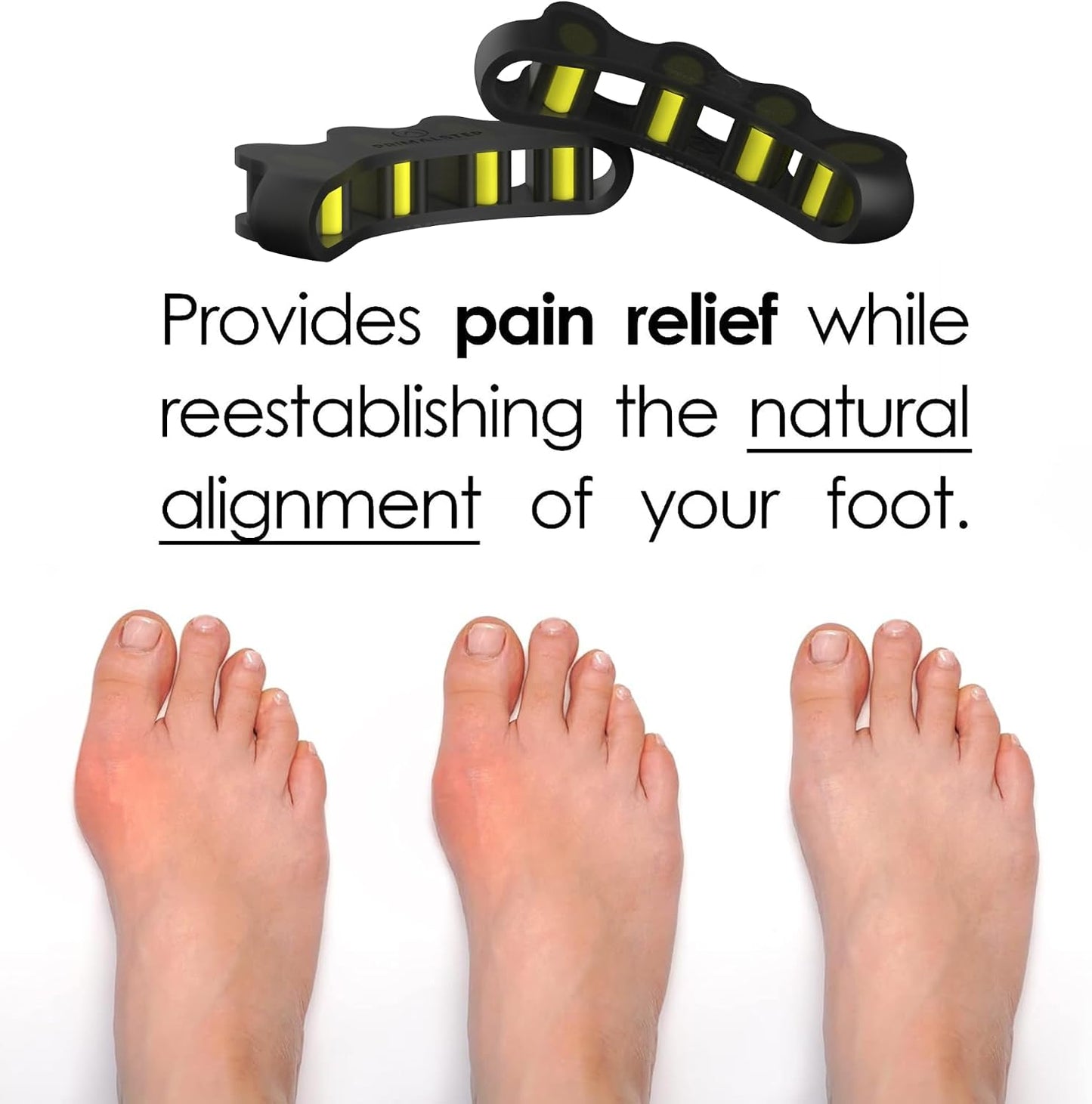 VYCE PrimalStep Toe Separators, Spreaders, Spacers, Straightener to Correct Toes for Men and Women, Bunion Corrector, Plantar Fasciitis and Athletic Mobility, S/M