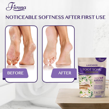 Fivona Tea Tree Foot Soak Blend 14.1 oz - Epsom Salt with Essential Oils for Healthy Toenails, Soothing Relief, Callus Softening - Pedicure Therapy for Soft, Rejuvenated Feet