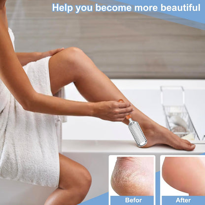 Professional Foot Scrubber Dead Skin Remover, Pedicure Foot File Callus Removal, Heel Scraper for Cracked Heels, Microplane Cheese Grater for Feet, Foot Rasp for Hard Skin(T1)