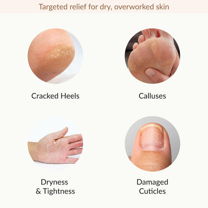 Epielle Hydrating Foot Mask 6 Pairs, Relieve and Soften with Shea Butter & Jojoba Oil, Deep Moisturizing Socks for Dry, Cracked Feet, Self Care Gifts for Women, Spa Kit