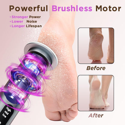 Electric Foot Callus Remover with 2600mAh Battery, 60Pcs Sandpaper Discs