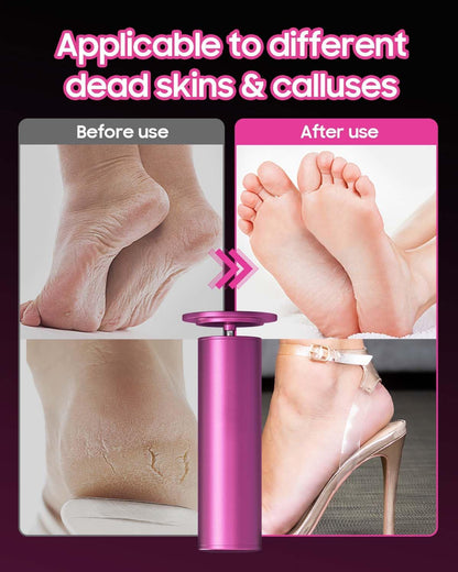 HayZBao Electric Foot Callus Remover - Electric Callus Remover for Feet,Foot Scrubber with 60 Pcs Sandpaper Discs,Professional Pedicure Tool for Dead Skin - Black