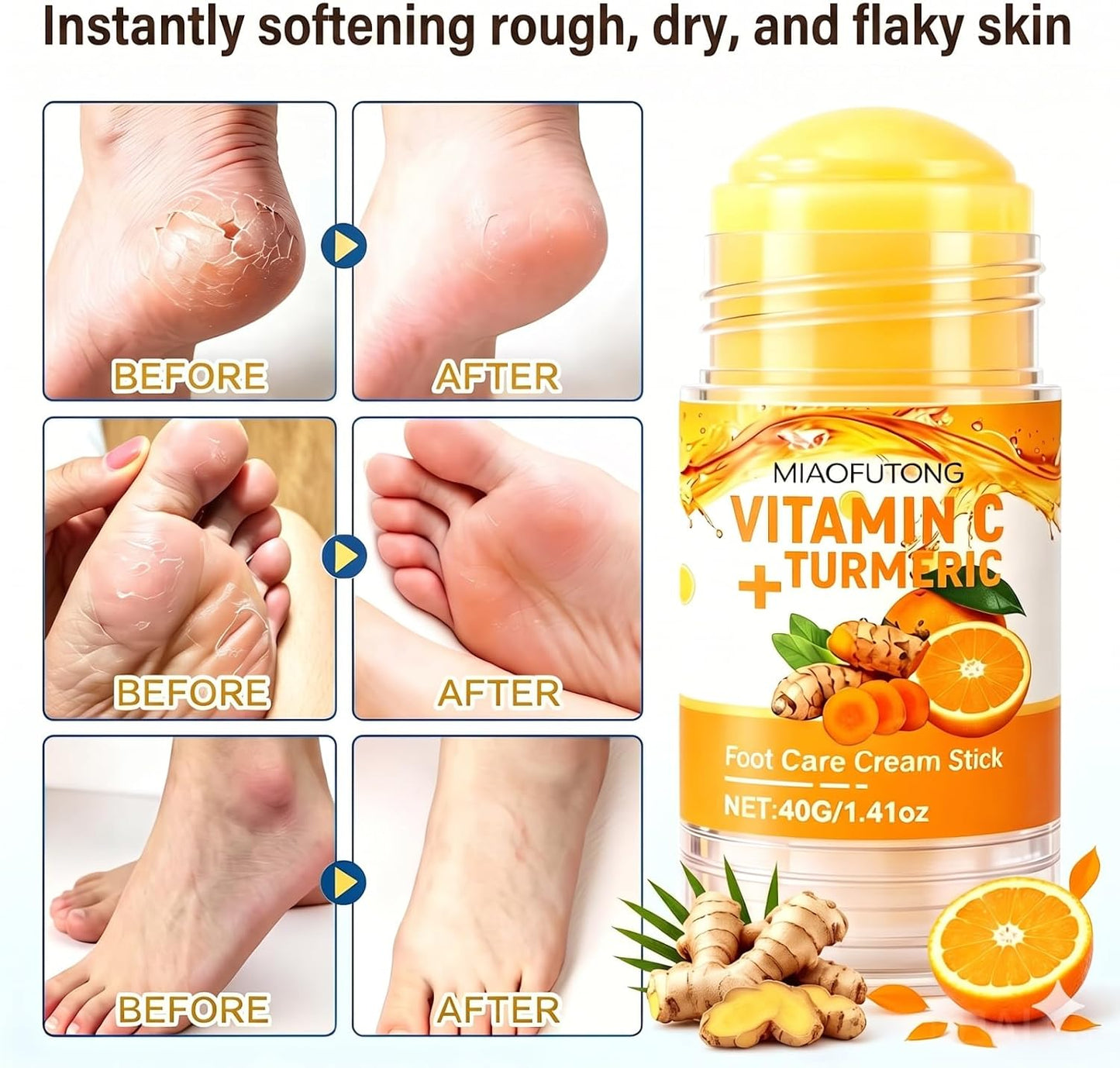 Electric Foot Callus Remover Rechargeable Foot File for Dead Skin | 3 Speeds Callus Remover for Feet, Waterproof Foot Care Pedicure Kit with Foot Cream, Ideal Gift for Men and Women