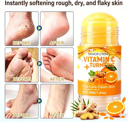 Electric Foot Callus Remover Rechargeable Foot File for Dead Skin | 3 Speeds Callus Remover for Feet, Waterproof Foot Care Pedicure Kit with Foot Cream, Ideal Gift for Men and Women