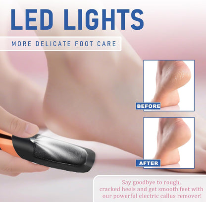 LQT® Electric Foot File – Rechargeable Callus Remover for Hard, Cracked Skin – At-Home Pedicure Kit for Smooth Feet (Men & Women) (White)