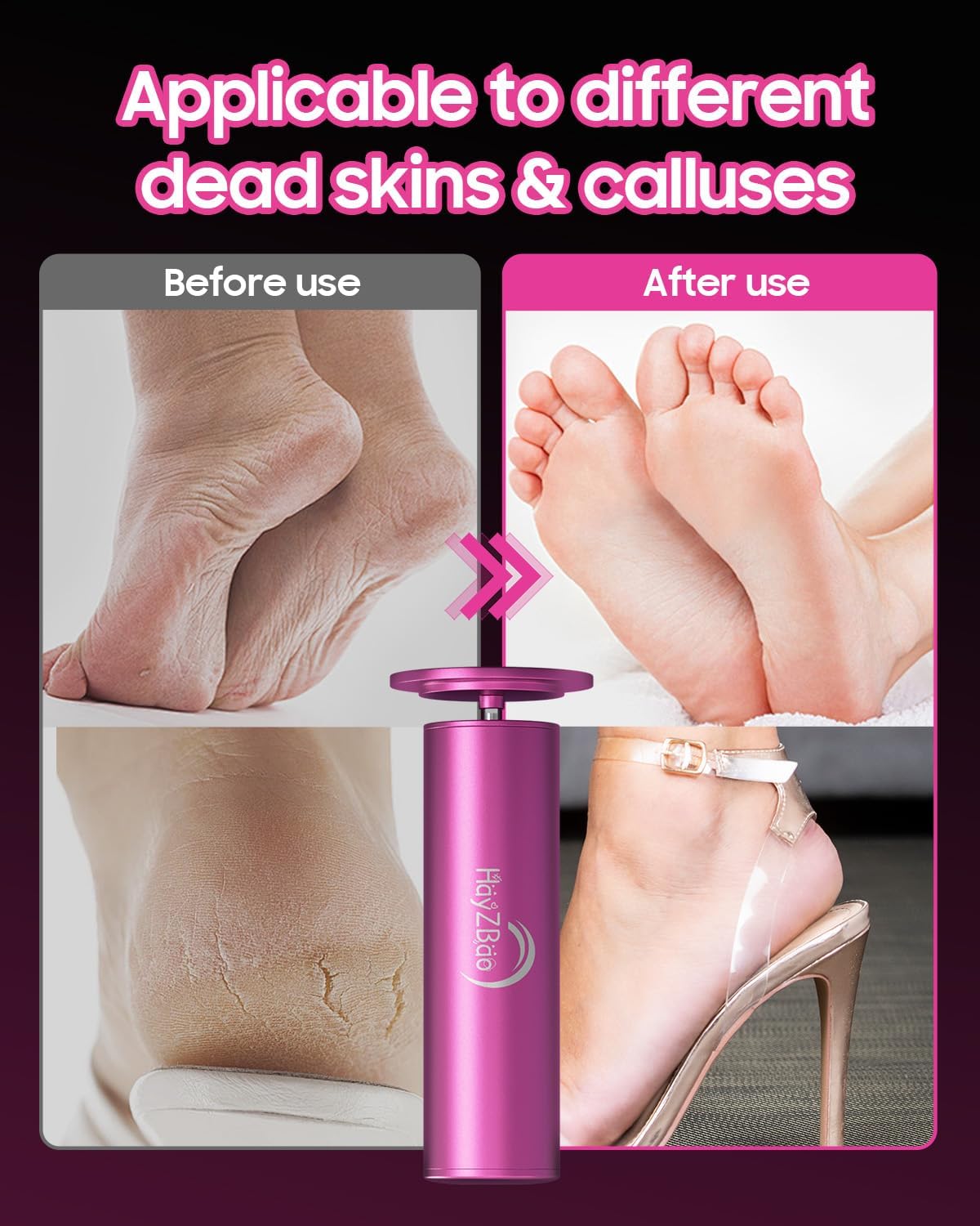 HayZBao Electric Foot Callus Remover - Electric Callus Remover for Feet,Foot Scrubber with 60 Pcs Sandpaper Discs,Professional Pedicure Tool for Dead Skin - Black