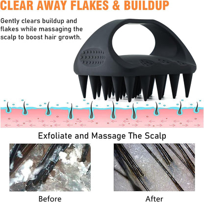 YEALIR Scalp Massager Shampoo Brush, Scalp Scrubber for Dandruff & Build Up, Scalp Massager Hair Growth - 100% Silicone, Plastic Free