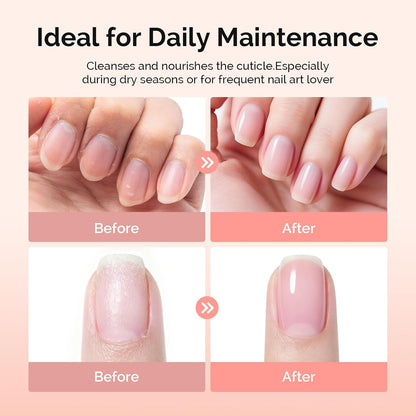 MelodySusie 16Pcs Professional Nail Buffer Kit,Nail Files and Buffers,Nail Buffer Block,Nail Brush, Nail File Buffers Kit for Natural Nails,DIY,Home Use,Salon（100/180 Grit）