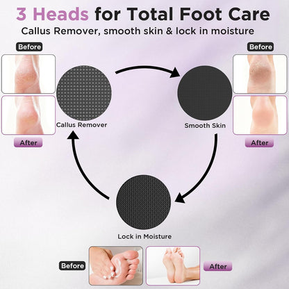Electric Foot Callus Remover, Apply Oil,Foot File,Reusable Nano-Glass Head, Ergonomic Premium Aluminum Callus Remover for feet, Professional Foot SPA Pedicure Tool at Home
