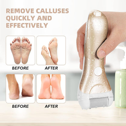 Callus Remover for Feet, Nicebirdie Electric Foot File Callus Removers Rechargeable Waterproof Pedicure Tools Foot Scrubber Shaver Feet Care Tool for Cracked Heels Dead Skin （Green）