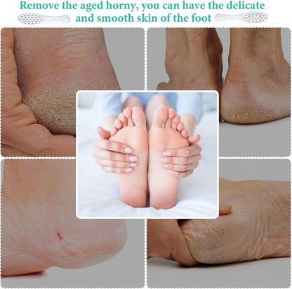 2 Pcs Stainless Steel Foot File Callus Remover Double Sided Metal Foot Scraper Rasp Scrubber for Wet or Dry Skin Professional Pedicure Tool for Hard Skin Cracked Heels Feet (Classic Style)