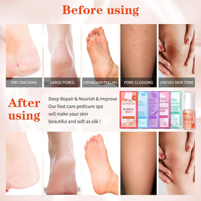 Pedicure Kit Foot Soak Set: Bubble Salt, Sugar Scrub, Massage Mask, Massage Lotion in a Box, 4 Step Foot Spa Kit for Dry Feet, Softens Calluses, Tired Feet（3 Set Lavender) - Colors A