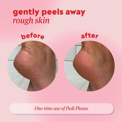 Onyx Professional Pedi Please Foot Mask - Quick Peeling, Gently Peels Away Rough Skin to Reveal Soft Smooth Skin, Includes Built-in Brush & Scrubbing Applicator, 5 fl. oz.