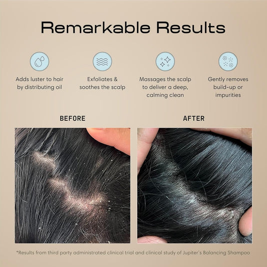 Jupiter Scalp Exfoliator - Scalp Massager Tool for Wet & Dry Hair - Ergonomic Detangler Brush - Dandruff Comb & Scrub to Remove Dandruff & Buildup and Support Circulation - Black/White