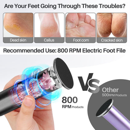 LIONVISON Electric Foot Callus Remover: Adjustable Speed Foot File for Cracked Heels - Working Women's Summer Pedicure Tool with 60pcs Sandpaper Discs - Dead Skin Remover for Dry Feet at-Home