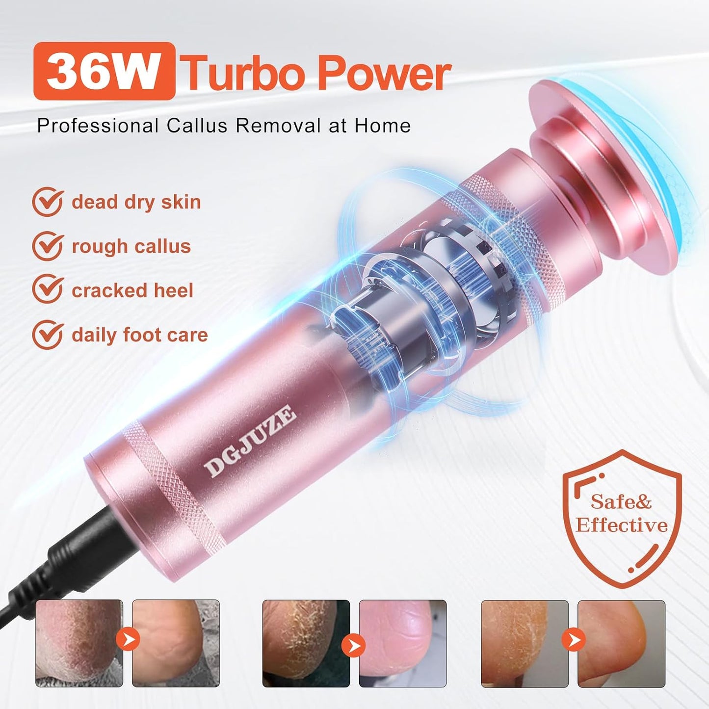 Electric Foot Callus Remover 36W, 1200RPM Heavy Duty Metal Grinder | 36W Motor, 60PCS Sandpaper Discs, Metal Body, Plug-in Corded, for Cracked Heels & Calluses, Home & Salon Pedicure Tool