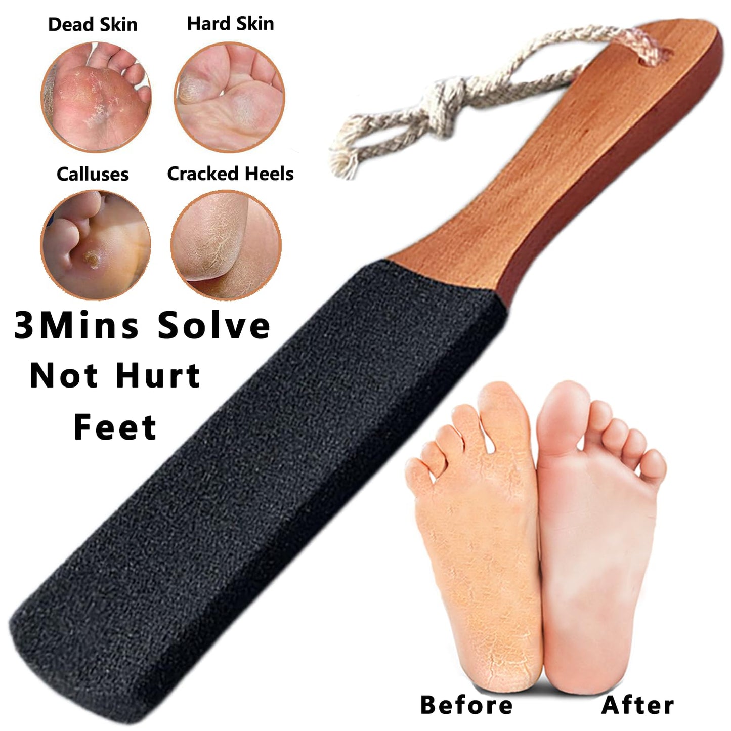 Kinepi Foot File & Foot Scrubber,Pumice Stone for Feet Callus Remover | Pedicure foot rasp helps smooth cracked heels,dead skin,and hard skin after shower for wet or dry daily and weekly foot care