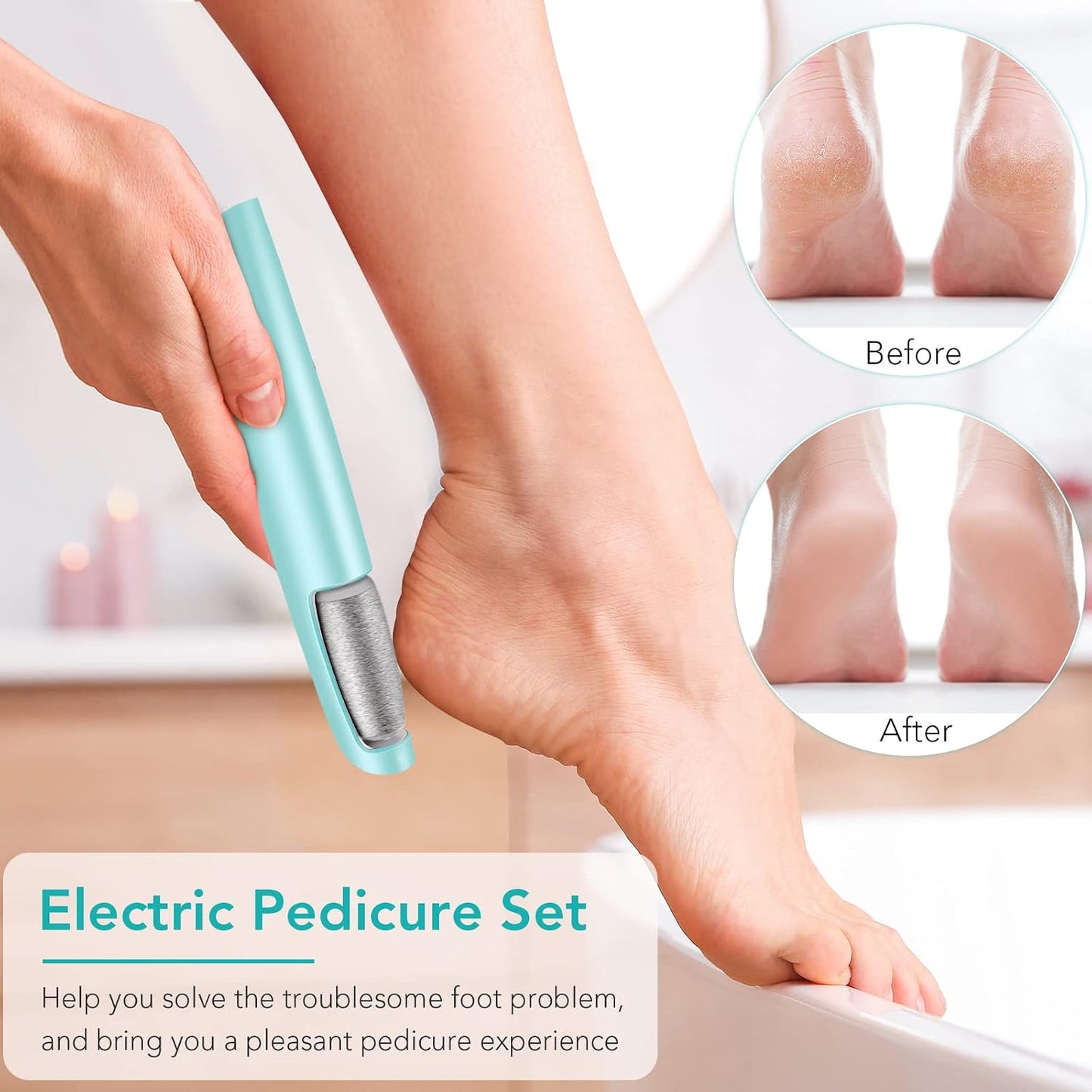 LINKEVAP Electric Callus Remover for Feet, Professional Pedicure Kit Foot Scrubber for Dry, Dead, Cracked, Hard Skin, at Home Feet Spa Care Kit for Men & Women (Cold White)
