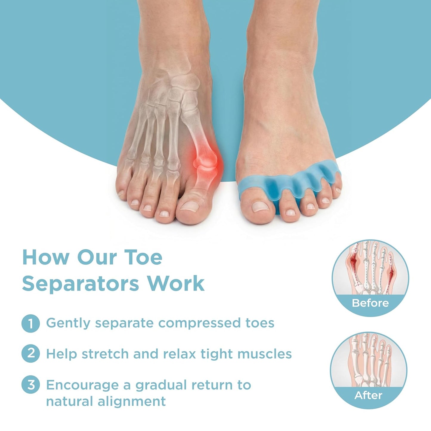 Mind Bodhi Toe Separators/Toe Spacers - For Men and Women - Regular Size – Blue
