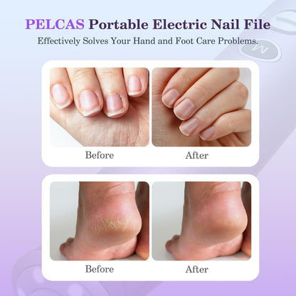 PELCAS Electric Nail Grinder, 10 Speeds Cordless Nail Drill with LED Light, Portable Manicure and Pedicure Kit, Nail File with LCD Screen for Human, Pet, Thick Toenails, Natural & Acrylic Nails Grey