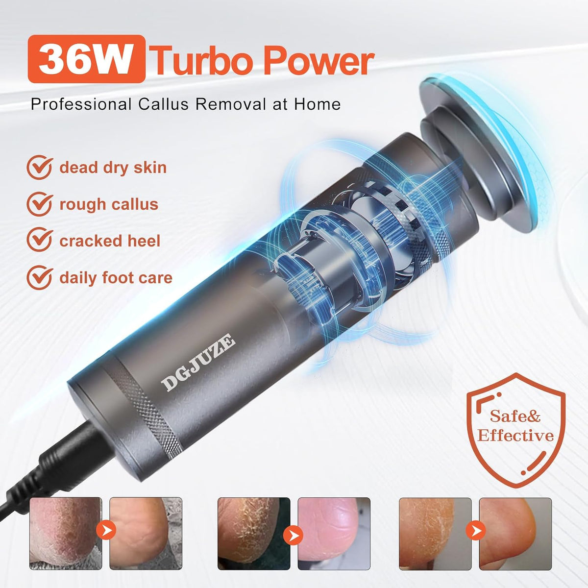 Electric Foot Callus Remover 36W, 1200RPM Heavy Duty Metal Grinder
