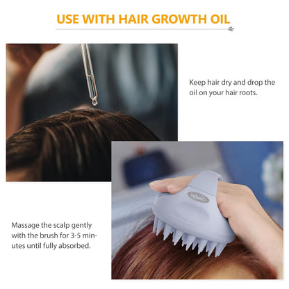 Sndyi Scalp Massager Shampoo Brush, Scalp Scrubber with Soft Silicone Bristles, Scalp Exfoliator for Dandruff Removal, Scalp Massager for Hair Growth, Wet Dry Hair Brush for Scalp Care, Green