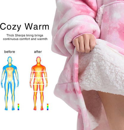 Kipswiza Wearable Blanket Hoodie Gifts for Women and Men, Oversized Cozy Warm Flannel Sherpa Hooded Blankets Sweatshirt with Giant Pockets for Adult and Teens, Dark Gray