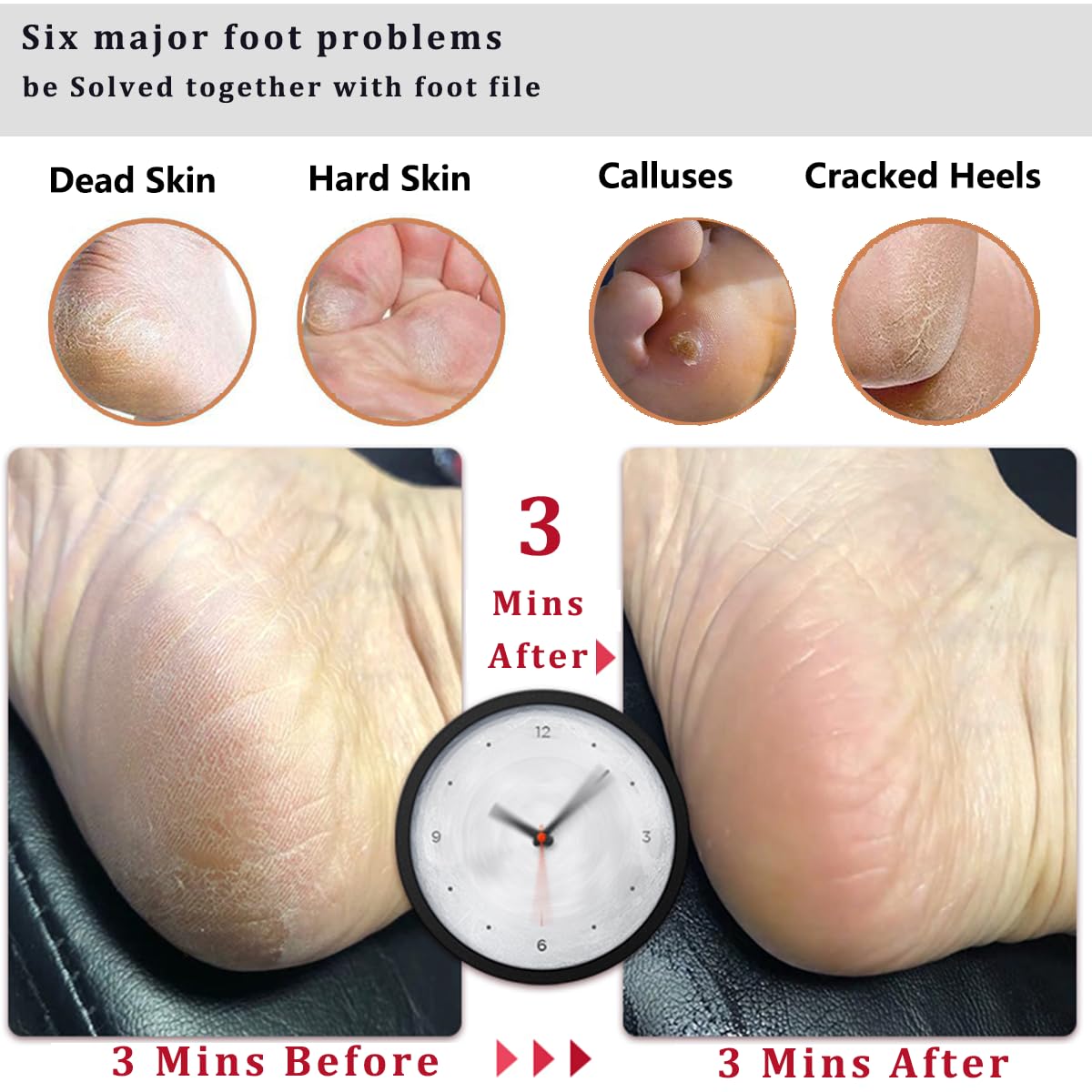 Kinepi Foot File & Foot Scrubber,Pumice Stone for Feet Callus Remover | Pedicure foot rasp helps smooth cracked heels,dead skin,and hard skin after shower for wet or dry daily and weekly foot care