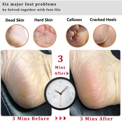 Kinepi Foot File & Foot Scrubber,Pumice Stone for Feet Callus Remover | Pedicure foot rasp helps smooth cracked heels,dead skin,and hard skin after shower for wet or dry daily and weekly foot care